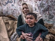 "أونروا": تسجيل 40 ألف إصابة بالالتهاب الكبد الوبائي في قطاع غزة