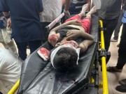 شهيدان ومصابون جراء قصف مدفعية الاحتلال لمنطقة الشيخ ناصر بخان يونس