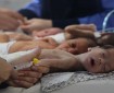 استشهاد الطفل حكمت بدر في دير البلح بسبب سوء التغذية