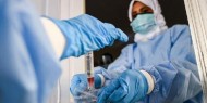 الصحة: 9 وفيات و336 إصابة جديدة بفيروس كورونا