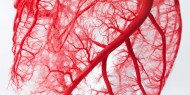 أمراض الأوعية الدموية.. المسببات وطرق الوقاية والعلاج