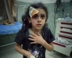 «أونروا»: أطفال غزة يعانون مستويات توتر مدمرة