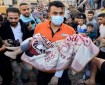 صحة غزة: ارتفاع عدد شهداء العدوان على غزة إلى 34183 شهيدا و 77143 مصابا